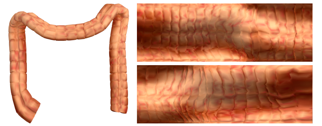 圖一：大腸曲面模型及其矩形保面積參數化
