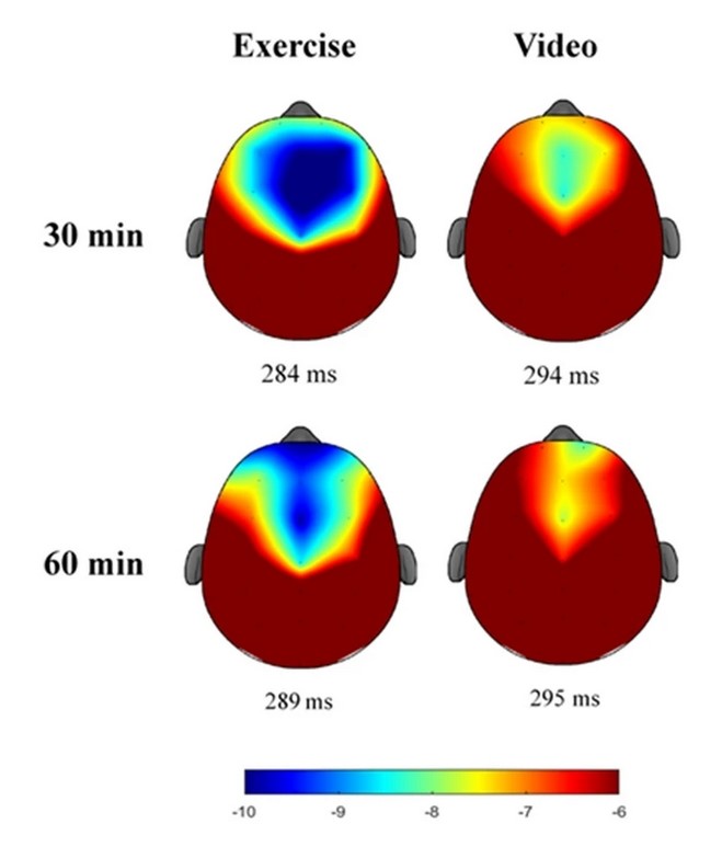 圖一：ERP-N2震幅的腦地形分布圖