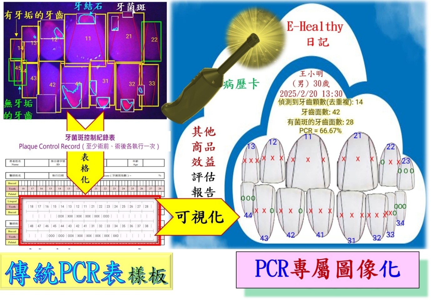圖2：「牙垢診斷病歷魔法棒」的AIoT APP可以即時辨識牙齒、牙垢(含牙菌斑與牙結石) ，並可以自動生成傳統牙垢控制紀錄表PCR、病歷圖像。