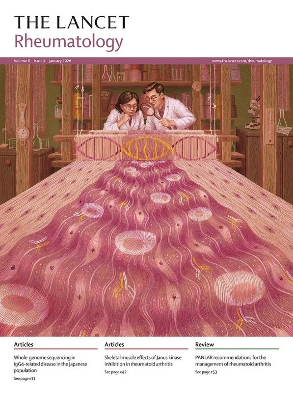 Emma為《The Lancet》2026年風濕免疫領域整年期刊繪製封面。圖為她根據刊登於1月號裡被選為封面的研究所繪製,以織布機呈現若源頭(DNA)出問題,就會織出歪七扭八的布,過度活化的免疫細胞、IgG4抗體、纖維母細胞將造成器官功能異常。(Emma提供)